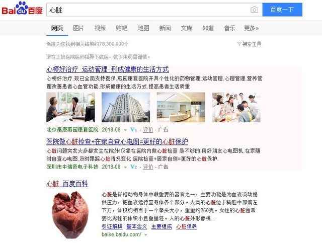鯰魚來了 百度你是那只爭氣的沙丁魚嗎？ 